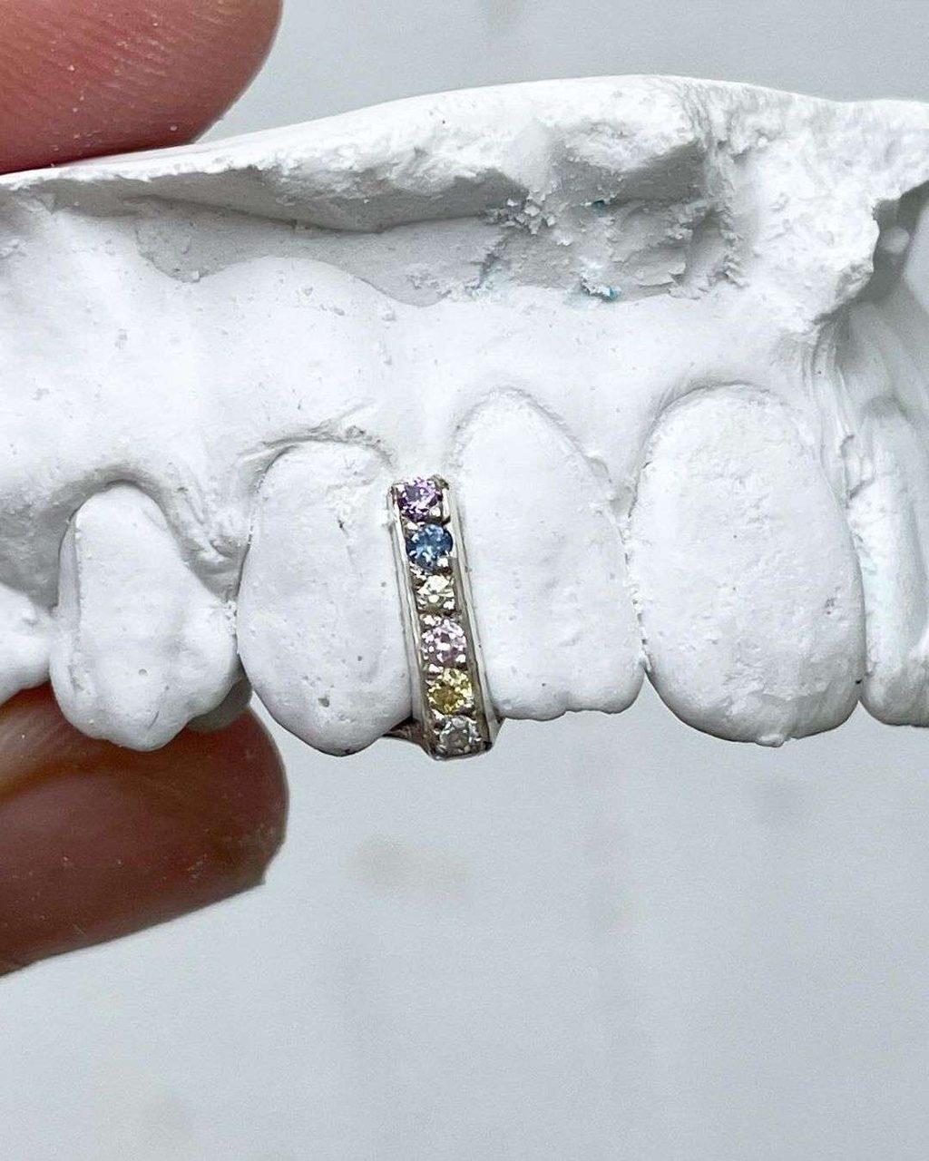 SWEET TOOTH: THE TEETH-JEWELLERS YOU SHOULD KNOW ABOUT