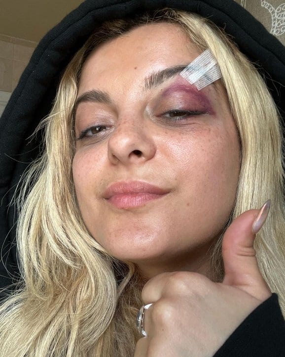 Do we really need to tell you not to throw s*** at celebrities?